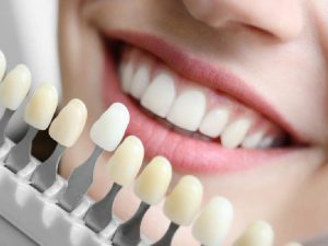 راهنمای خرید اینترنتی مواد دندانپزشکی